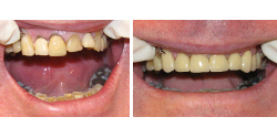 Cosmetic Dental Treatment North Wales