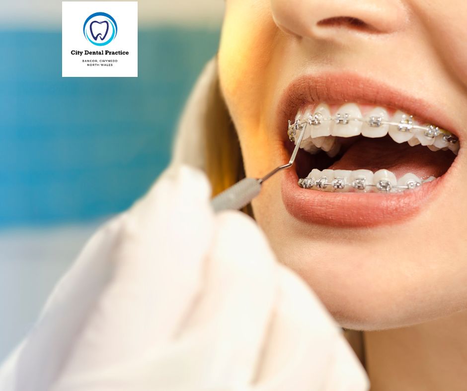 Dental Braces, Dr Behnam Aminnejad