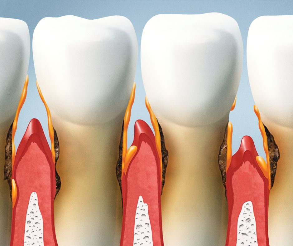 Toothache and causes, Dr Behnam Aminnejad